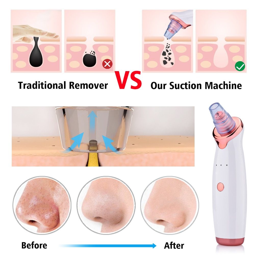 Electric Blackhead Remover & Facial Pore Cleaner