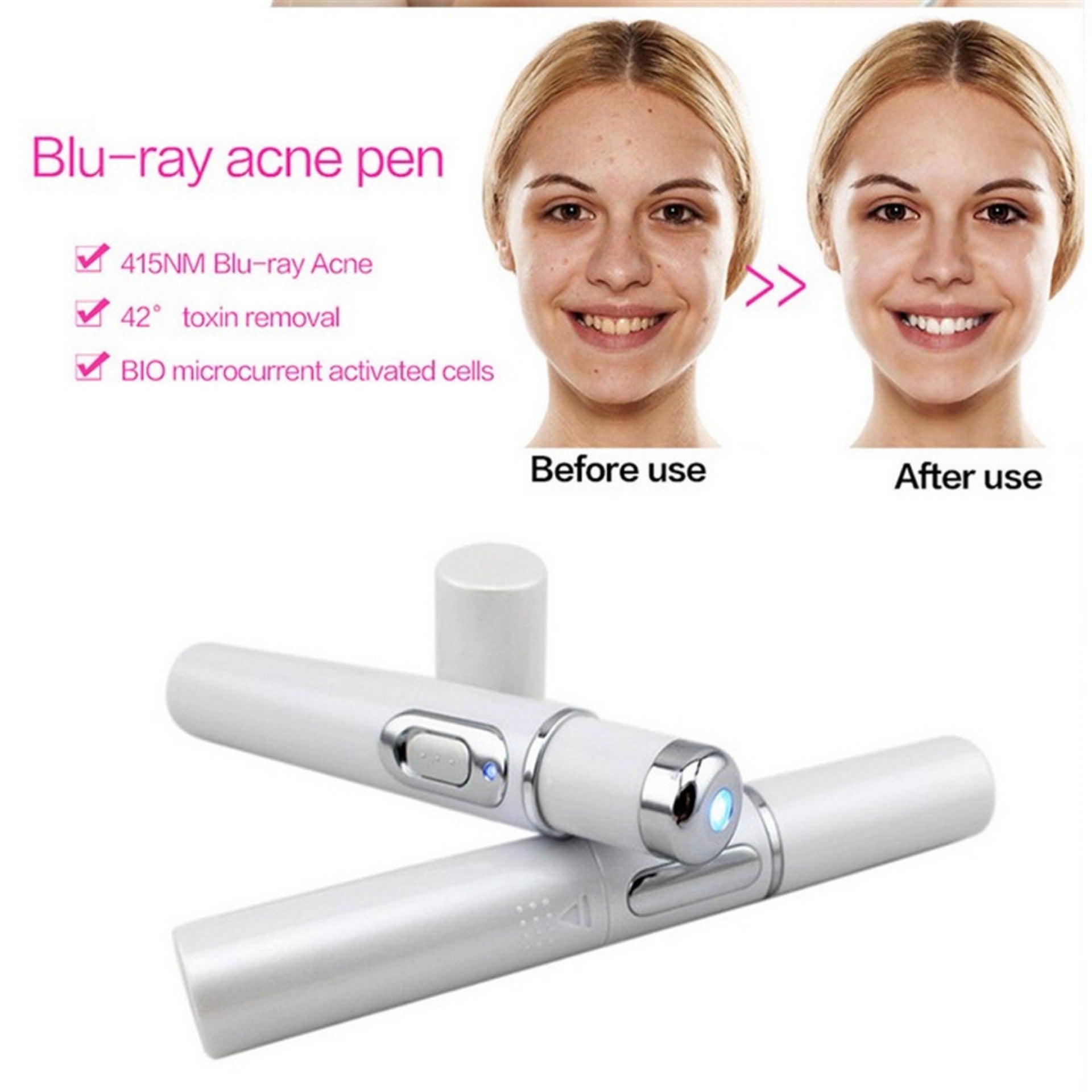 Blue Light Acne & Scar Treatment Laser Pen