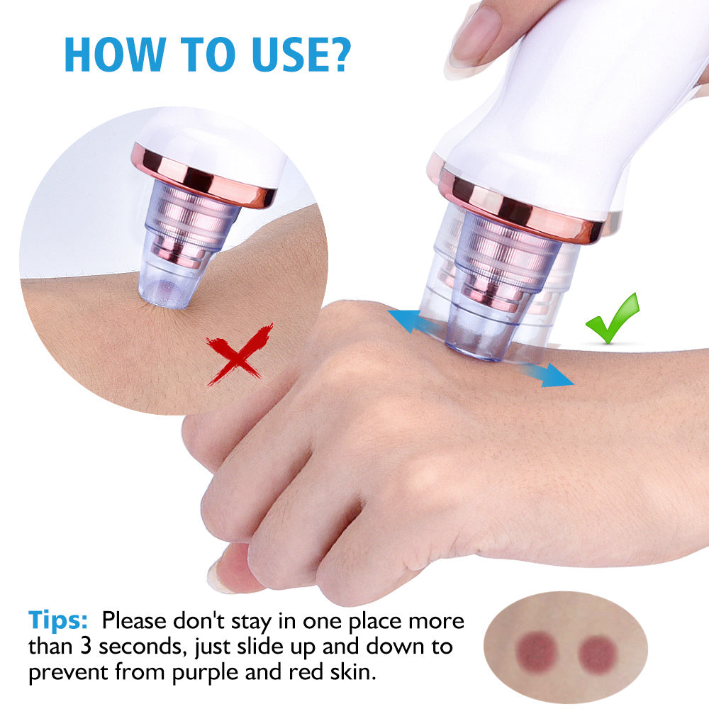 Electric Blackhead Remover & Facial Pore Cleaner