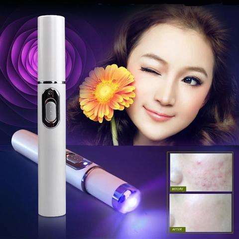 Blue Light Acne & Scar Treatment Laser Pen