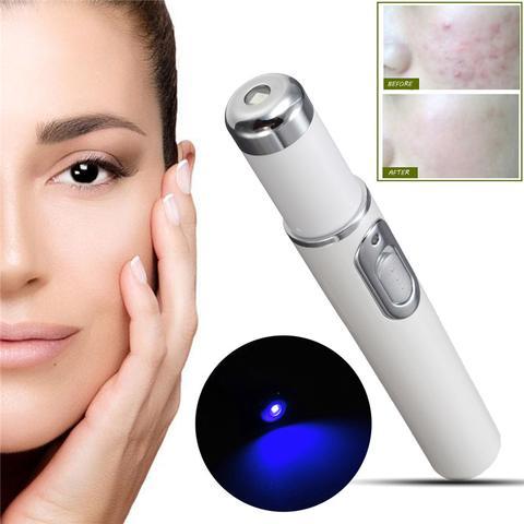 Blue Light Acne & Scar Treatment Laser Pen
