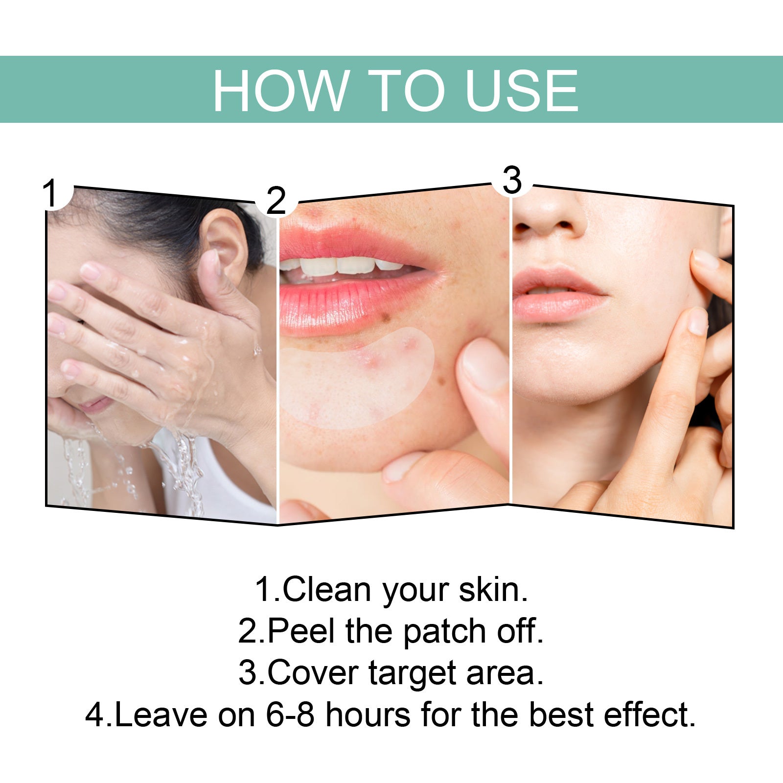 Gentle Acne Relief Patches for Healing and Clearer Skin